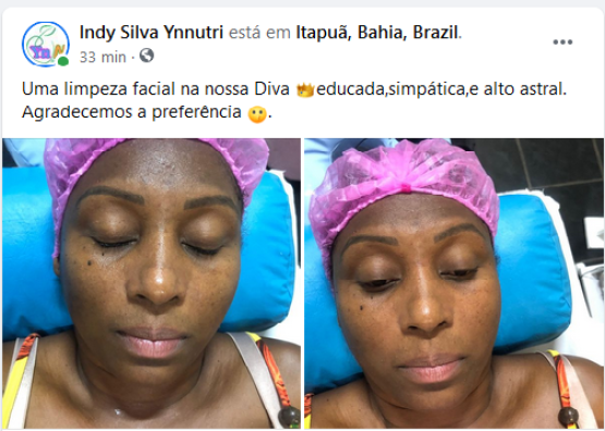 Limpeza de Pele